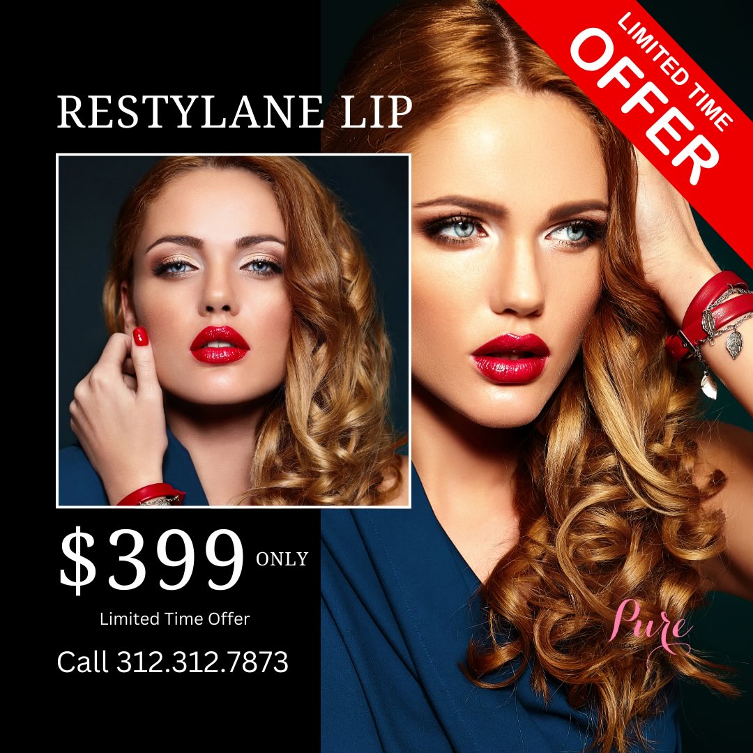 Restylane Lip $399